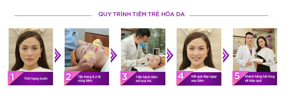 tiêm trẻ hoá da giá bao nhiêu
